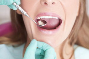 dentist, oral laser surgery, mouth health